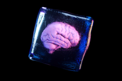 Il tessuto cerebrale resiste al congelamento (fonte: FlashMovie, iStock)