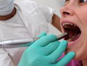 Igiene dentale più frequente se ho l'apparecchio ortodontico (ANSA)