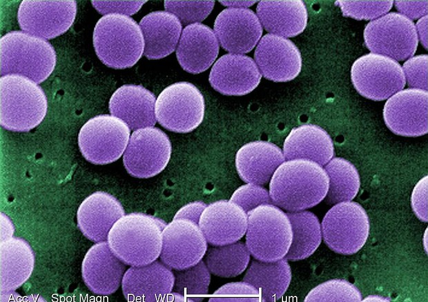 Uno dei più pericolosi super-batteri, lo Staphylococcus aureus (fonte: CDC) © Ansa