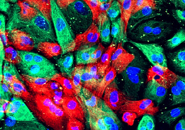 Tessuto della prostata coltivato in laboratorio (fonte: NIH) © Ansa