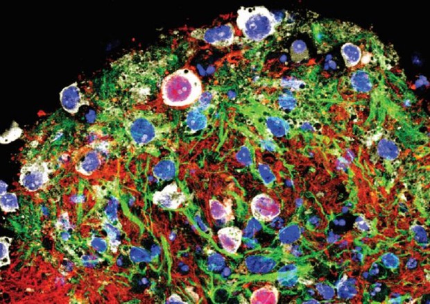 Immagine al microscopio di un cicuitoide formato da cellule nervose coltivate dalle staminali (fonte: Salk Institute) © Ansa