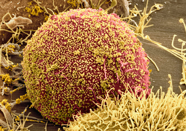 Una particella del virus Hiv vista al microscopio (fonte: Thomas Deerinck, NCMIR/SPL) © Ansa