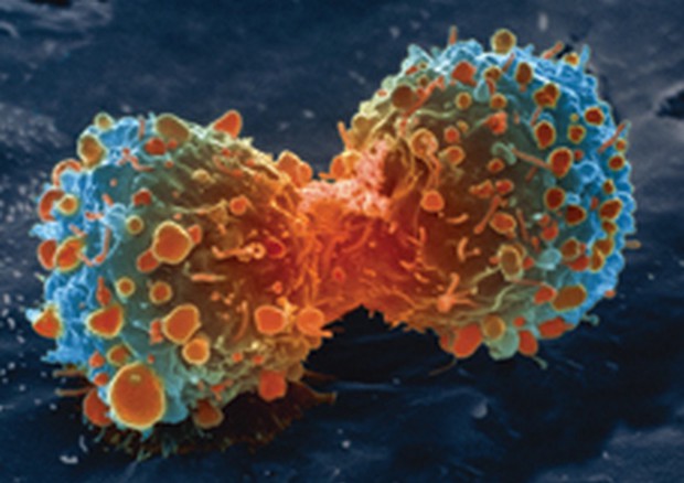 Una cellula tumore nel momento in cui si divide (fonte: United States: National Institutes of Health) © Ansa