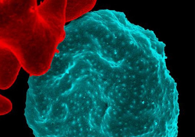 In blu una callula del sangue infettata dal parassita della malaria (fonte: NIAID-NIH) © Ansa