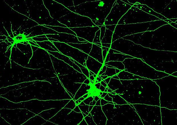 Cellule neuronali coltivate in 3D nel progetto Erc Minerva (fonte: Politecnico di Milano) © Ansa