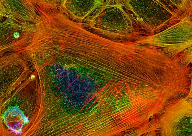 Immagine al microscopio dello scheletro di una cellula, che ne permette i movimenti. (fonte: Howard Vindin/Wikipedia) Immagine al microscopio dello scheletro di una cellula, che ne permette i movimenti. (fonte: Howard Vindin/Wikipedia) © Ansa