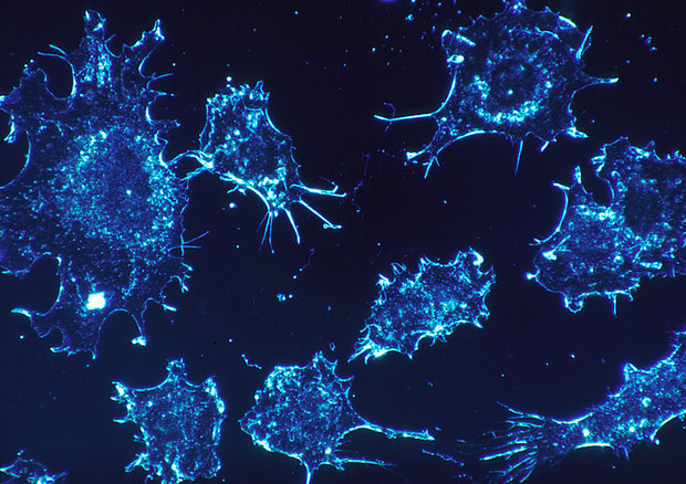 Cellule tumorali in coltura (fonte: National Cancer Institute) © Ansa