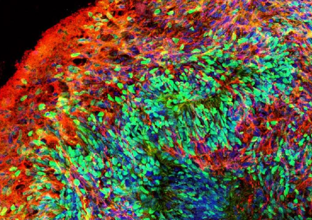 Particolare di un organoide del cervello umano (fonte: Ranjie Xu/Rutgers University-New Brunswick) © Ansa