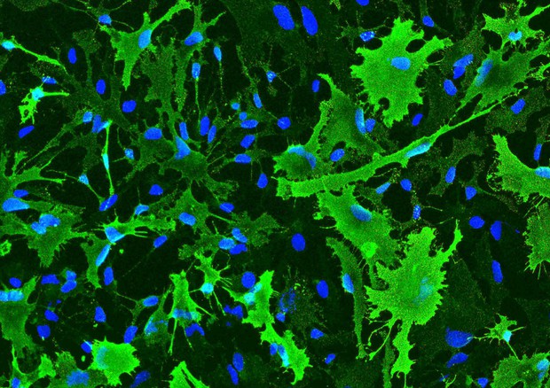 Cellule staminali cerebrali  (fonte: Laboratorio Cellule Staminali, Cell Factory e Biobanca dell'azienda ospedaliera Santa Maria di Terni) © ANSA