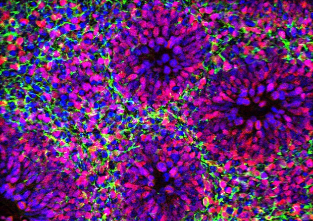  Dopo un mese di coltura, l'organoide contiene ammassi di cellule che diventeranno neuroni (fonte: laboratorio di Paola Arlotta, Harvard University) © Ansa