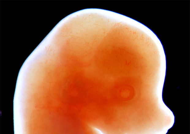 Particolare dell'embrione di un topo a 13 giorni (fonte: Craig Rhodes e Kenneth Yamada, National Institute of Dental and Craniofacial Research, National Institutes of Health) © Ansa