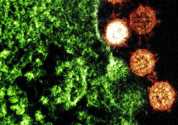 Particelle del virus della Sars (fonte: NIAID) © Ansa