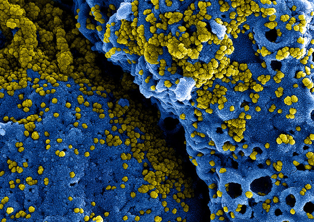 Particelle di coronavirus viste al microscopio elettronico (fonte: NIAID, Flickr) © Ansa