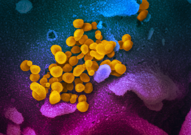 Particelle del coronavirus SarsCov2 sulla superficie di una cellula, ottenute dal Niaid (fonte: NIAID-RML) © Ansa