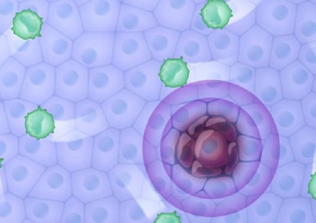 Cellule tumorali possono continuare a replicarsi perché si nascondono al sistema immunitario (fonte: CIBSS/University of Freiburg, Michal Roessler) © Ansa
