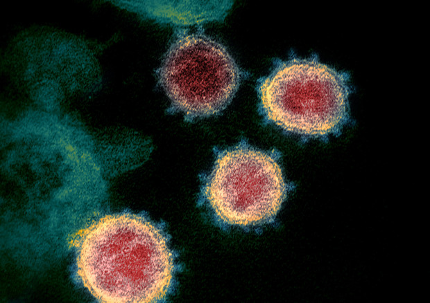 Il coronavirus SarsCoV2 visto al microscopio elettronico (fonte: NIAID-RML) © Ansa