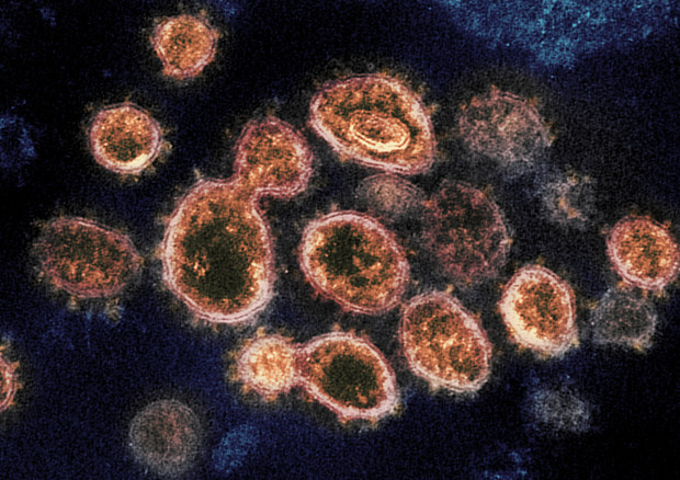 Il coronavirus SarsCoV2 (fonte: NIAID-RML) © Ansa