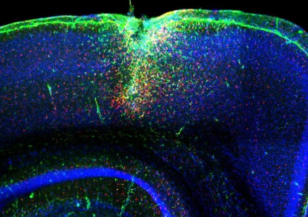 I neuroni attivati dalla luce grazie alla molecola nata in laboratorio (fonte: IIT) © Ansa