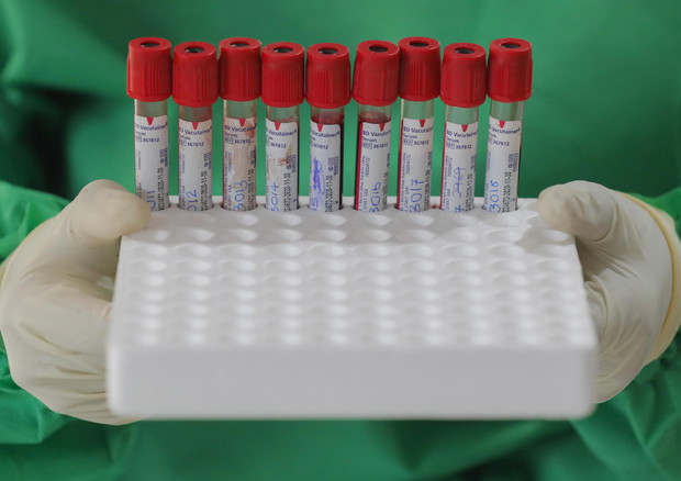 Covid: studio Iss dimostra persistenza degli anticorpi © EPA