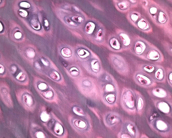 Una colonia di staminali pluripotenti indotte (fonte: Salk Institute for Biological Studies)