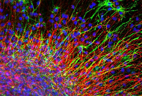 Cellule staminali neurali (fonte: Yvonne Nolan, Louise Collins, Suzanne Crotty, University College Cork, Ireland)