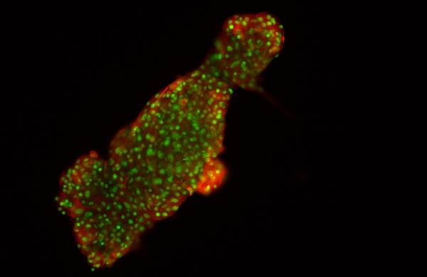 Corpo lentoide derivato dall'epitelio della lente isolato dalle cellule staminali embrionali (fonte: F. Mengarelli, T. Barberi, Monash University)
