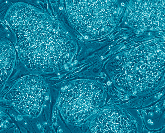Cellule staminali embrionali umane