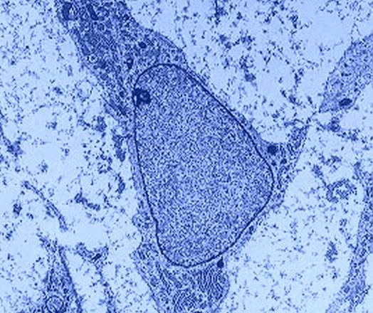 Cellule staminali mesenchimali (fonte: Robert M. Hunt)