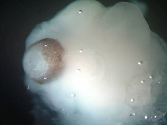 Il mini cervello umano visto al microscopio; il tessuto cerebrale si trova accanto a quello della retina, più scuro (fonte: Madeline A. Lancaster)
