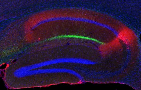 Le 'cellule isola' nell'ippocampo del cervello di topo (fonte: Riken)