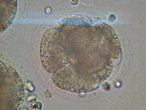 Una foto di archivio mostra le immagini al microscopio di cellule staminali adulte isolate per la prima volta dal cuore umano e, successivamente trattate in laboratorio