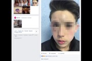 Bullismo, il papà del 13enne: 'Ecco perché ho pubblicato la foto'