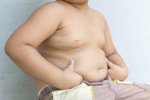 In Italia 6 mln obesi, 15.000 ogni anno ricorrono al bisturi (ANSA)