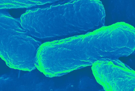 Il batterio Escherichia coli (fonte: University at Buffalo) © Ansa