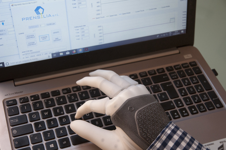 La mano robotica permanente può essere controllata anche per eseguire movimenti complessi (fonte: DeTOP project – Integrum – Chalmers Yniversity od Technology) © Ansa