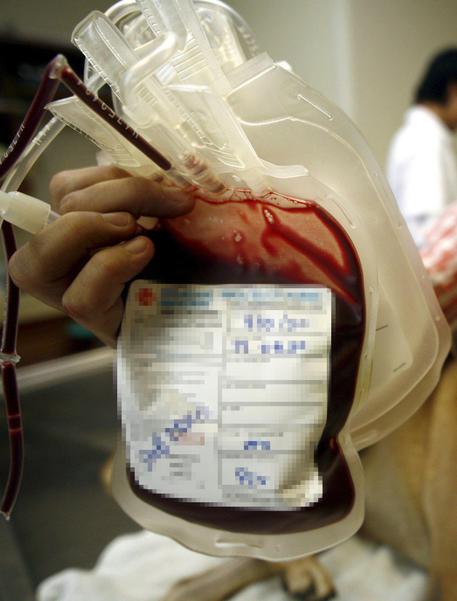 Una sacca di sangue per trasfusioni in una foto di archivio. © ANSA