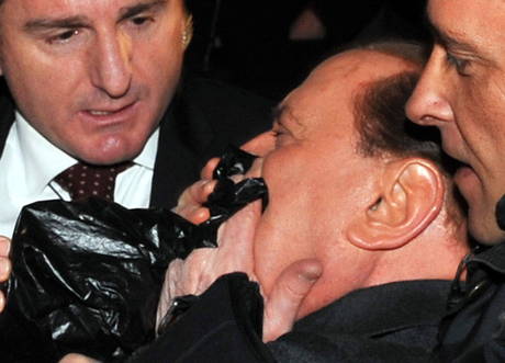Della prima, quella tra la guardia del corpo di Berlusconi (nella prima foto) e Tartaglia (nella seconda foto) ne abbiamo parlato ampiamente, noi del web - in113xt2X_20091213