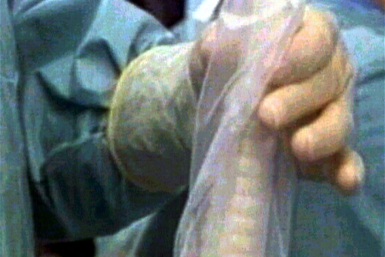Un fermo- immagine del Tg1 di un momento dell 'operazione, in una sala operatoria, dell 'impianto nell 'utero di un embrione - RIPRODUZIONE RISERVATA