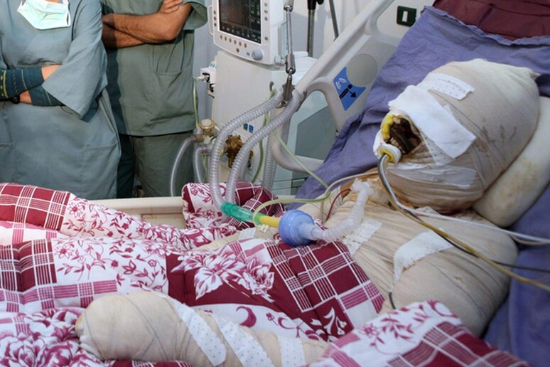Mohamed Al Bouazzizi, l 'uomo che si è dato fuoco il 17 dicembre 2010 nell 'ospedale di Ben Arous vicino Tunisi, in una foto del 28 dicembre. Il 5 gennaio 2011, è morto per le  ferite riportate © ANSA/EPA