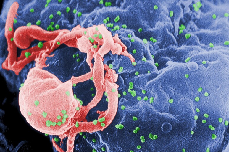 Il virus dell 'HIV - RIPRODUZIONE RISERVATA