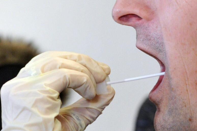 Verso test sangue e saliva per diagnosi precoce parodontite - RIPRODUZIONE RISERVATA