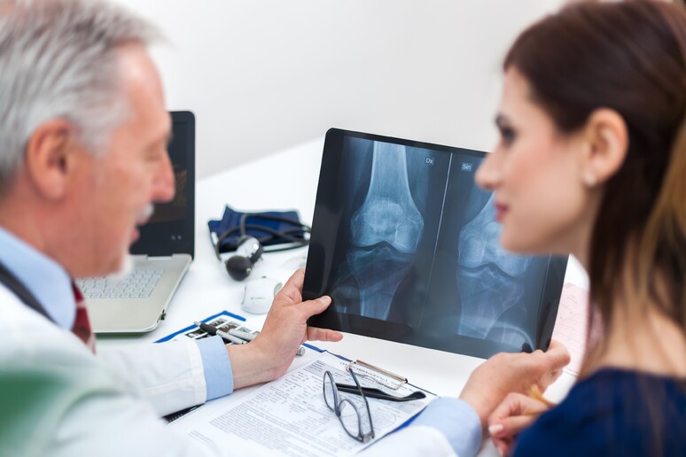 Osteoporosi, in Italia 5 milioni di pazienti a rischio - RIPRODUZIONE RISERVATA