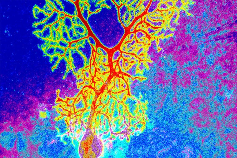 Neuroni in falsi colori (fonte:  Dana Simmons, University of Chicago) - RIPRODUZIONE RISERVATA