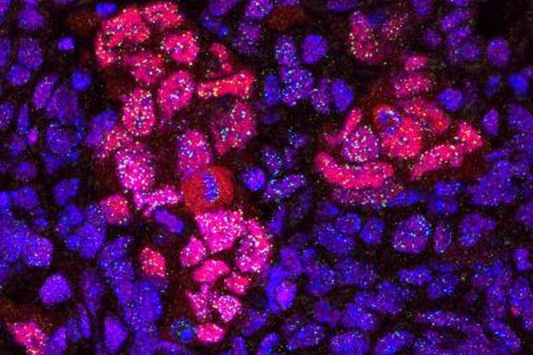 Proteine ​​del pancreas di un topo riprogrammato (Fonte: Spanish National Cancer Research Centre (CNIO)) - RIPRODUZIONE RISERVATA