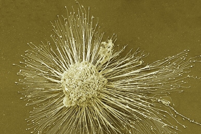 Cellule della pelle di un donatore anonimo sono state riprogrammate in cellule della retina (fonte: Thomas Deerinck, NCMIR/SPL) - RIPRODUZIONE RISERVATA