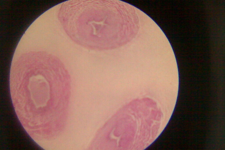 Tessuto del cordone ombelicale umano (fonte: Netha Hussain) - RIPRODUZIONE RISERVATA