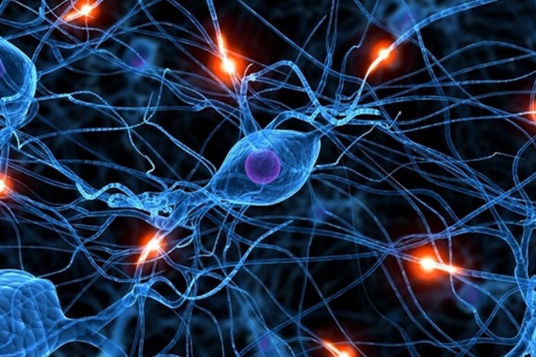 I neuroni alterati dal morbo di Parkinson (fonte: NIH) - RIPRODUZIONE RISERVATA