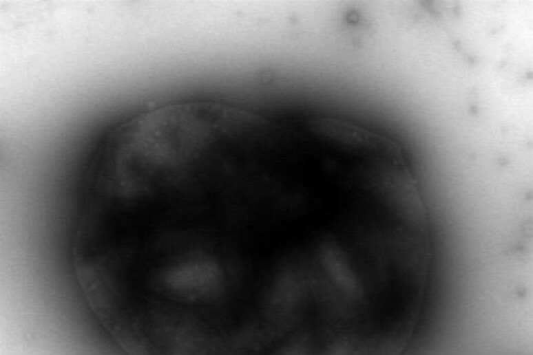 Il batterio mangia-metano M. acetivorans fotografato con il microscopio elettronico (fonte:  Thomas Wood, Penn State) - RIPRODUZIONE RISERVATA