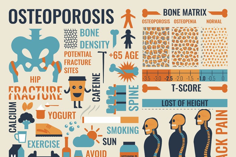 Diabete e osteoporosi, trattarli insieme e bene è possibile - RIPRODUZIONE RISERVATA