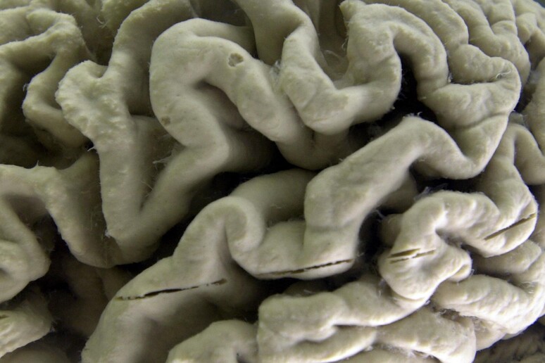 Connessione computer-cervello, Cernobbio si interroga © ANSA/AP